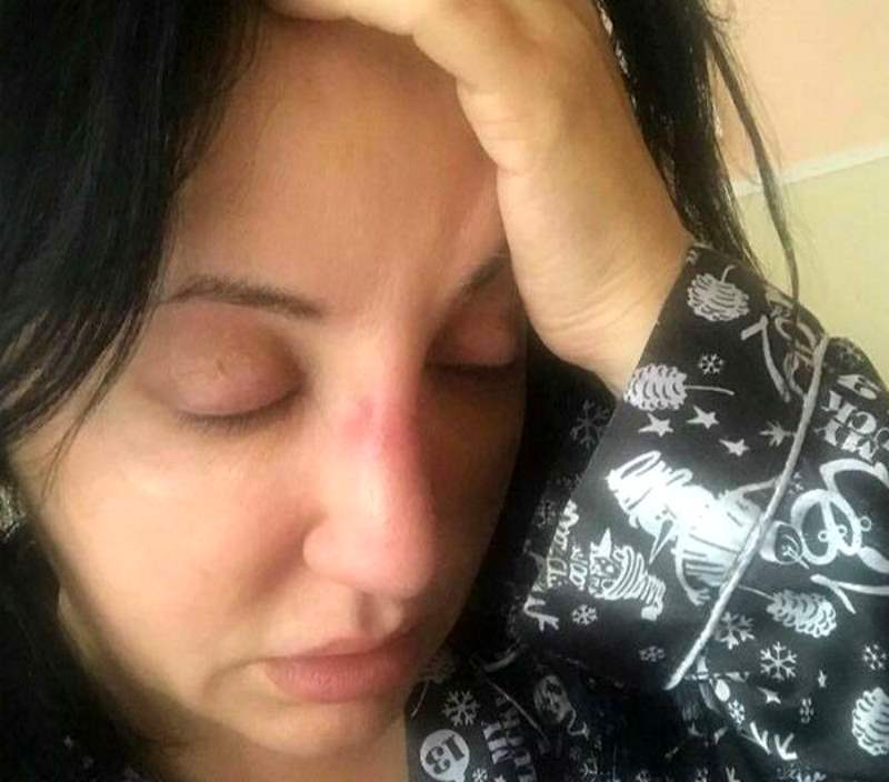 Фатима Хадуева пострадала от действий пластического хирурга